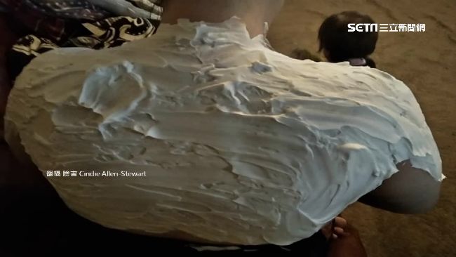 刮鬍泡舒緩曬傷？網友實測驚人效果！