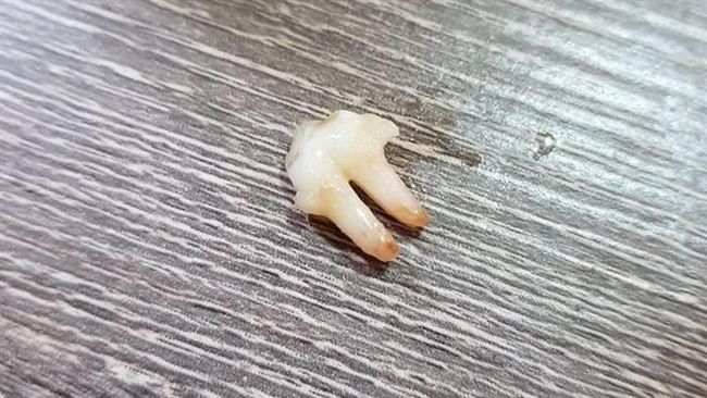 點豬頭肉吃到豬牙齒　網友焦點全歪樓