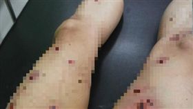 台中,酷刑,台新醫院,凌虐,急診（圖／翻攝畫面）