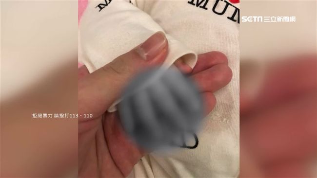 剪傷女嬰指甲…保母控遭雇主拔指簽票
