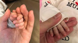 保母控遭拔指甲簽本票！女嬰父打臉