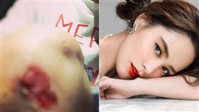 女星阿嬌（鍾欣潼）在欣賞血月的過程中不慎摔倒，膝蓋血肉模糊的模樣讓粉絲都好心疼。