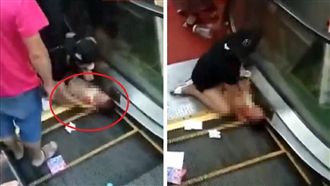 童遭手扶梯捲入　右臂骨斷只剩皮相連