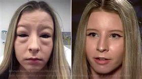 澳洲,Jade Kwong,堅果,漢堡,豬頭（圖／翻攝自Kristen Neville's Twitter）