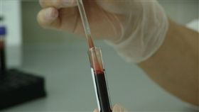 HIV,病毒,加拿大,愛滋病,研究,突變,潛伏期,發病,Saskatchewan, 圖／翻攝自pixabay　https://goo.gl/BDNx62