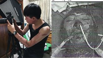 「我無法救他」毀容替代役揭沉痛噩夢