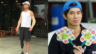 「我女兒還小」他毀容截肢　奇蹟甦醒