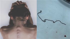 9公分裂頭蚴活蟲（寄生蟲）存少女腦內／pixabay、梨視頻
