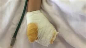 插座,金屬叉子,大陸,江蘇,觸電,燒傷(圖/翻攝自微博)