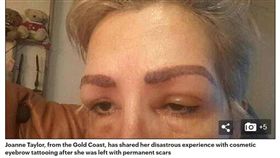 美容暗藏陷阱！她紋眼線不成反失明　慘痛經驗曝光　圖／翻攝自每日郵報