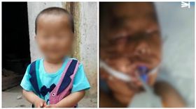 中國大陸6歲男童小宇遭鄰居狂砍20多昏迷不醒（圖／翻攝自《澎湃新聞》）