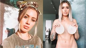 這假奶有毒！澳正妹隆乳後怪病纏身「被關在90歲身體裡」　圖／翻攝自ig