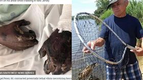 美國,海邊,螃蟹,感染,截肢（圖／翻攝自太陽報）