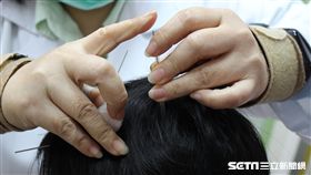 中醫師公會表示，透過中藥與電針，對於妥瑞兒與過動兒症狀有助緩解。（圖／中醫師公會提供）