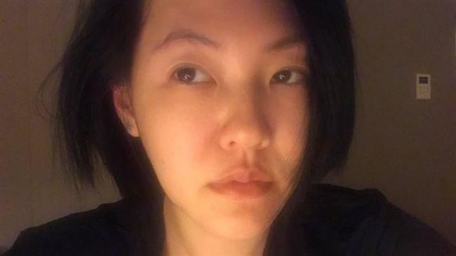 小S健身爆血！傷勢曝光網驚呼：好痛