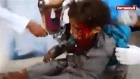 鬧市遭空襲　炸彈直擊載滿兒童公車
葉門,內戰,聯軍,叛軍,空襲
翻攝自推特