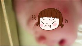 刀痕,剖腹,剖腹產,嬰兒,臉,南韓,新生兒,悔意,提告,手術　圖／翻攝自YouTube http://youtu.be/A4rvRjWnpow