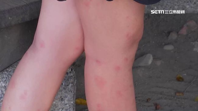 如何對付小黑蚊？網曝神招：抹花露水