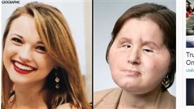 美國,Katie Stubblefield,舉槍自轟,毀容,臉部移植（圖／翻攝自USA YODAY）
