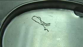 病患腦裡有寄生蟲，醫師建議他先將蟲養個2周。（圖／翻攝自新浪網）