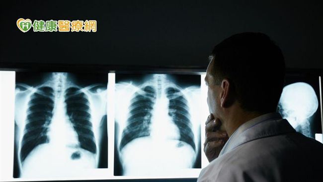 腰痠背痛好不了？恐是肺癌骨轉移作怪