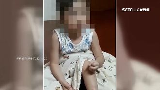 熱湯淋身、頭撞地板…2幼女滿身傷痕