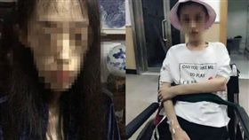 瘋狂減重剩25公斤　21歲女大腦像60歲還陷失憶(圖/翻攝自微博)