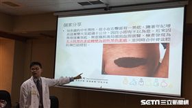 台北榮總皮膚部醫師李政源。（圖／記者楊晴雯攝）