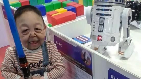 童滿臉皺紋萎縮如老人　母泣：害了他