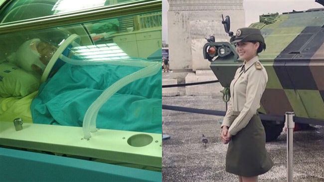 最美女憲兵遇塵爆　秀傷疤多次遭拒絕