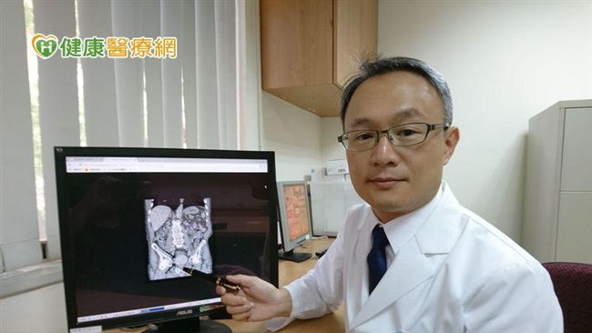 30歲女血尿以為感染　沒想到竟罹癌