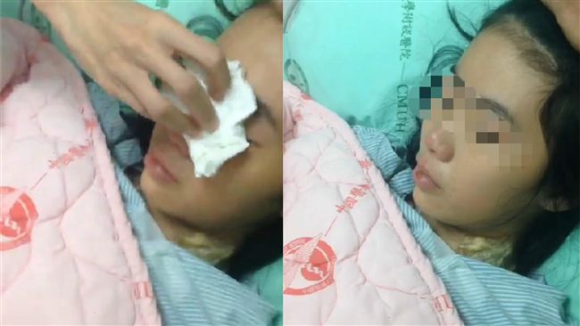 廣三SOGO手扶梯夾頸　少女清醒了