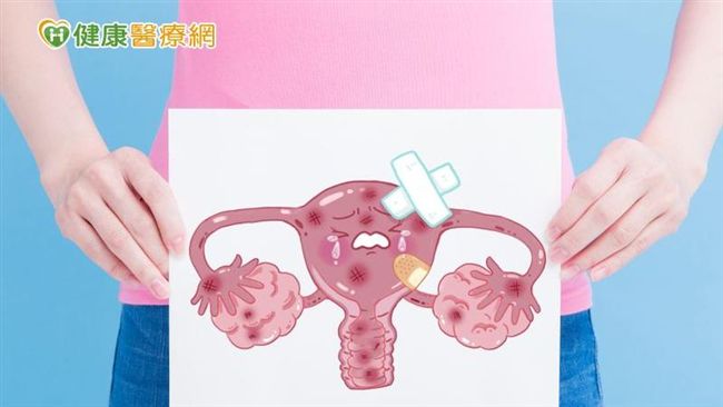 妙齡女郎腰變粗　竟因晚期卵巢癌作怪