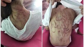 遭繼母虐打滿身「血痕烙印」　12歲女童習慣了：掉不出淚
圖翻攝自成都商報客戶端