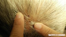 患者張先生遭龜殼花咬傷頭皮痕跡。（圖／台北榮總提供）