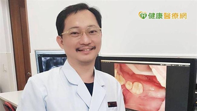 對植牙手術充滿迷惑？專家來解惑了！