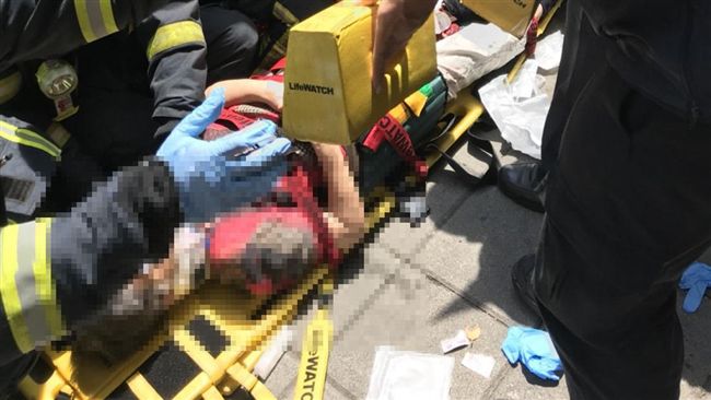 乘客未上車公車就開走　婦遭後輪輾過