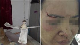 超衰！熟睡中吊扇突砸落　女子破相縫10針險失明　圖／翻攝自泰國網