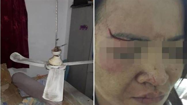 超衰！泰女熟睡中遭吊扇砸中險失明