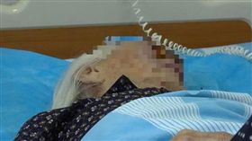 大陸老婦皮膚癌為積極治療，20年後臉部爬滿活蛆。（圖／翻攝自廣西人民廣播電台）