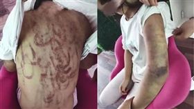 慎入！恐怖繼母虐童　女孩被打成「鬼畫符」（圖／翻攝自澎湃新聞）
