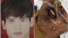 大陸發生公安意外，24男子被燙成木乃伊（圖／翻攝自微博）