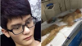 大陸發生公安意外，24男子被燙成木乃伊（圖／翻攝自微博）