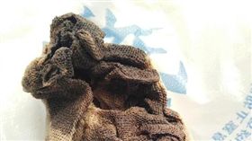 大陸河北一名34歲的賈姓女子今年5月到唐山市婦幼保健院做人工流產手術，沒想到術後她的下體頻頻傳出惡臭味，甚至還有液體流出。賈女就醫檢查後，才發現之前她做流產手術時，醫師忘記將紗布取出，而該塊紗布已發黑化膿。（圖／翻攝自法制晚報）