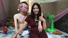 女友不離不棄伴3年半　患眼癌毀容男不敵病魔離世（圖／翻攝自臉書）