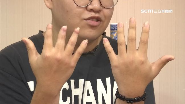 孝子職災絞斷3指！控餛飩名店冷處理