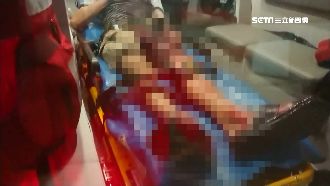 柏油路滿地血腳印！男遭刺傷求救保全
