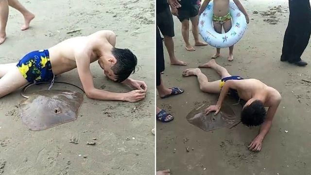 男被魟魚刺中GG　救援人員一刀剪斷