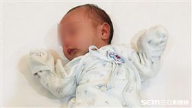 斜頸又稱「歪脖子」，是兒科常見疾病之一。（圖／台北慈濟醫院提供）