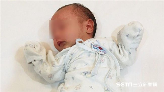 寶寶歪頭看人不是裝可愛　恐這病搞怪